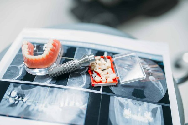 Les centres de denturologie offrent-ils des options de prothèses flexibles ?